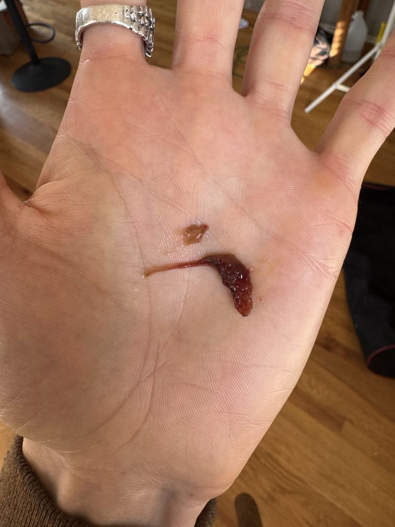 Biofilm chunk — dark, structured piece